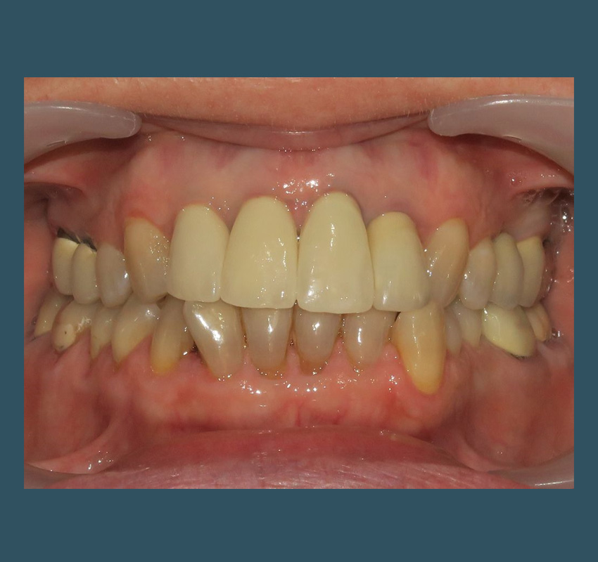 Orthodontiste Lyon 4